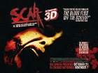 Scar